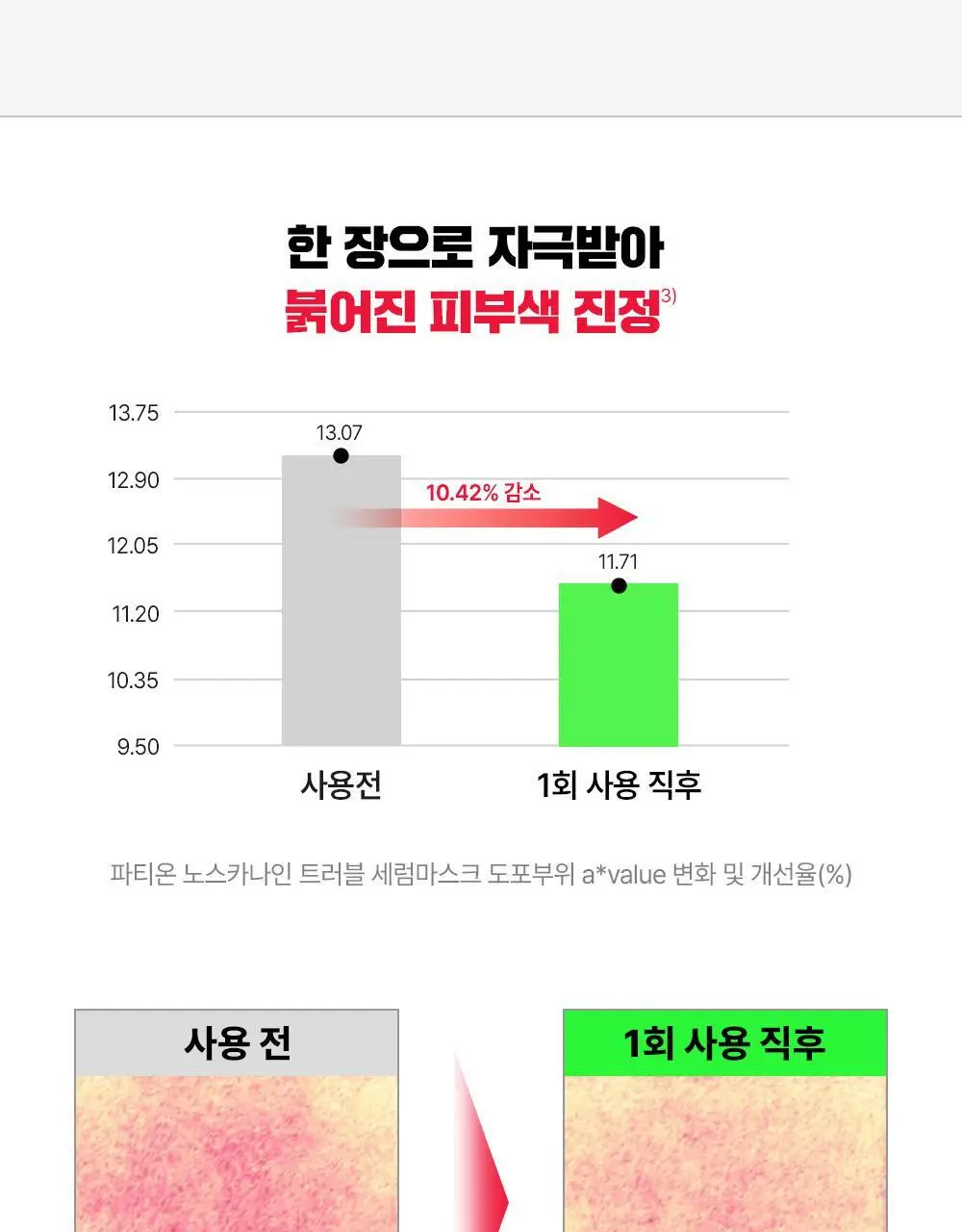 [트러블진정] 파티온 노스카나인 트러블 세럼 마스크팩 1매 상세페이지 19